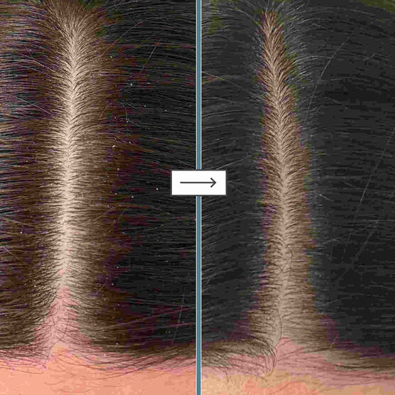 Óleo Capilar Briogeo Scalp Revival Rosemary Pre-Wash